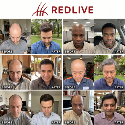 Redlive Therapy Cap